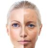 Aparato de Ultrasonido para la belleza de la Cara , 5 en 1  - imagen 13
