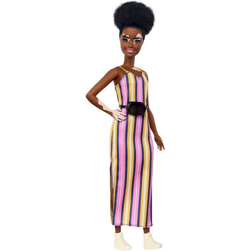 Barbie Fashionista Muñeca con Vitiligo